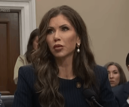 Kristi Noem Before Plastic Surgery These Shocking Old Photos Say It All | Foundation 66